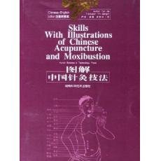 Skills with Illustrations of Chinese Acupuncture and Moxibustion 9787535744845