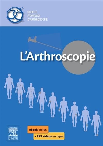 L'arthroscopie 9782294743542