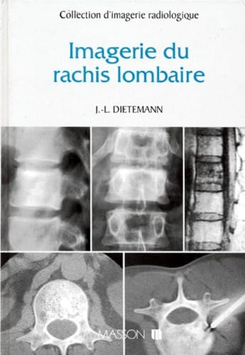 Imagerie du rachis lombaire 9782225846199