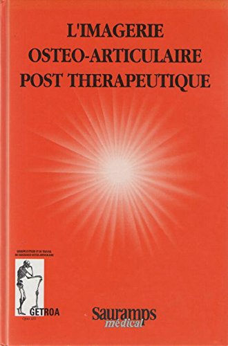 L'Imagerie osteo articulaire post therapeutique 9782840230212