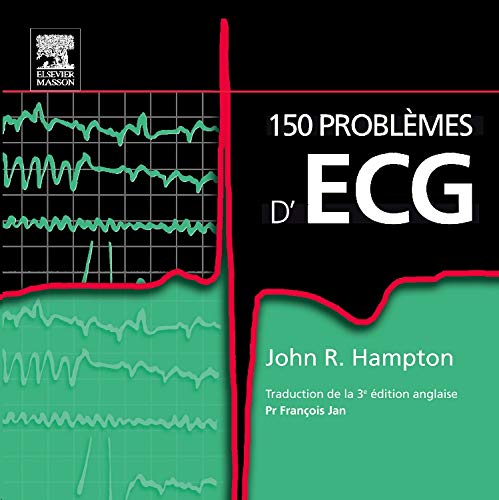 150 problèmes d'ECG (Ancien Prix éditeur : 38 euros) 9782810101498
