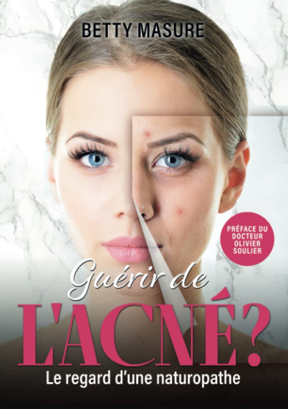 GUÉRIR DE L'ACNÉ ?: Le regard d'une naturopathe 9782958652906