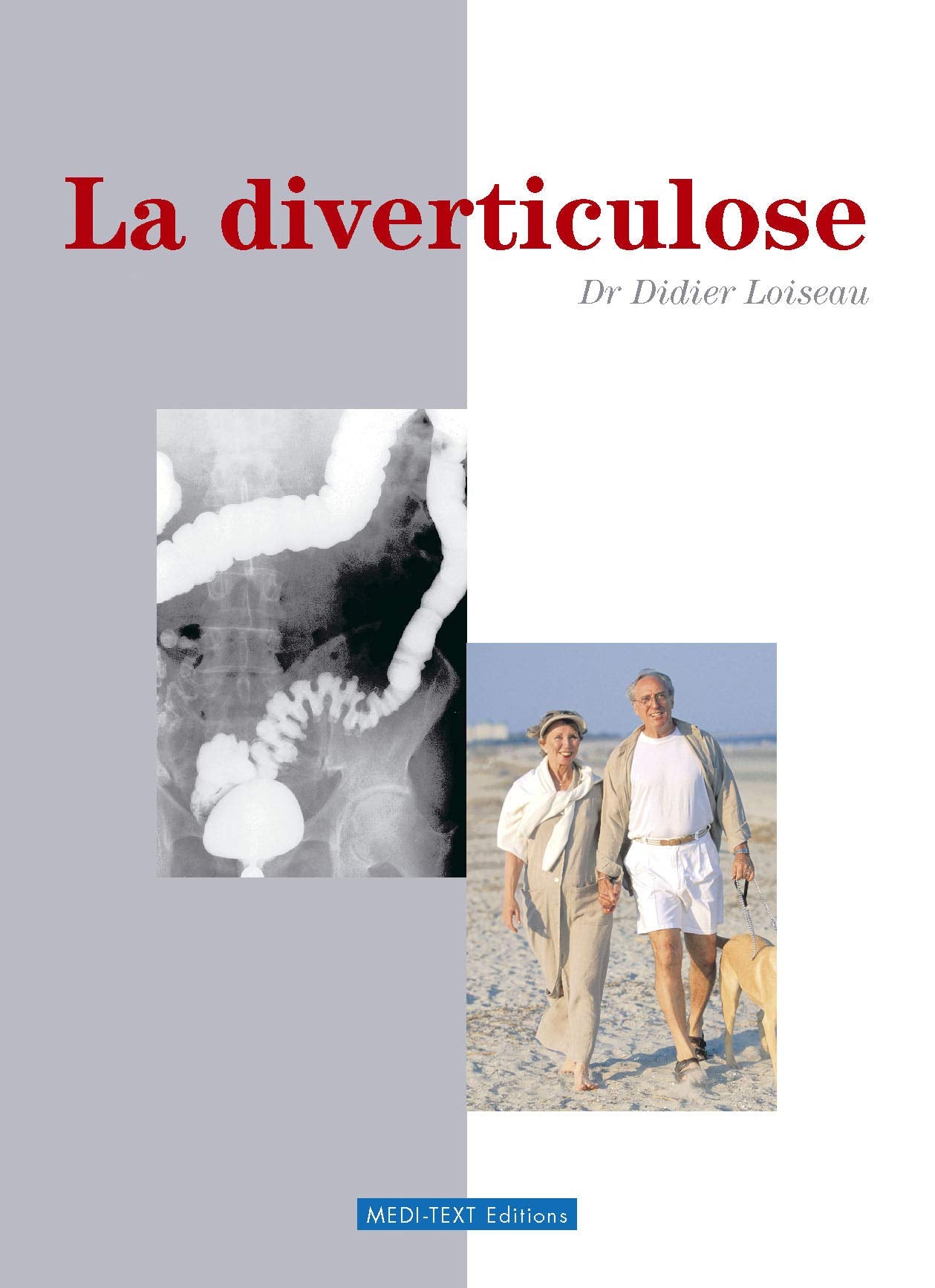 La diverticulose 9782915400069