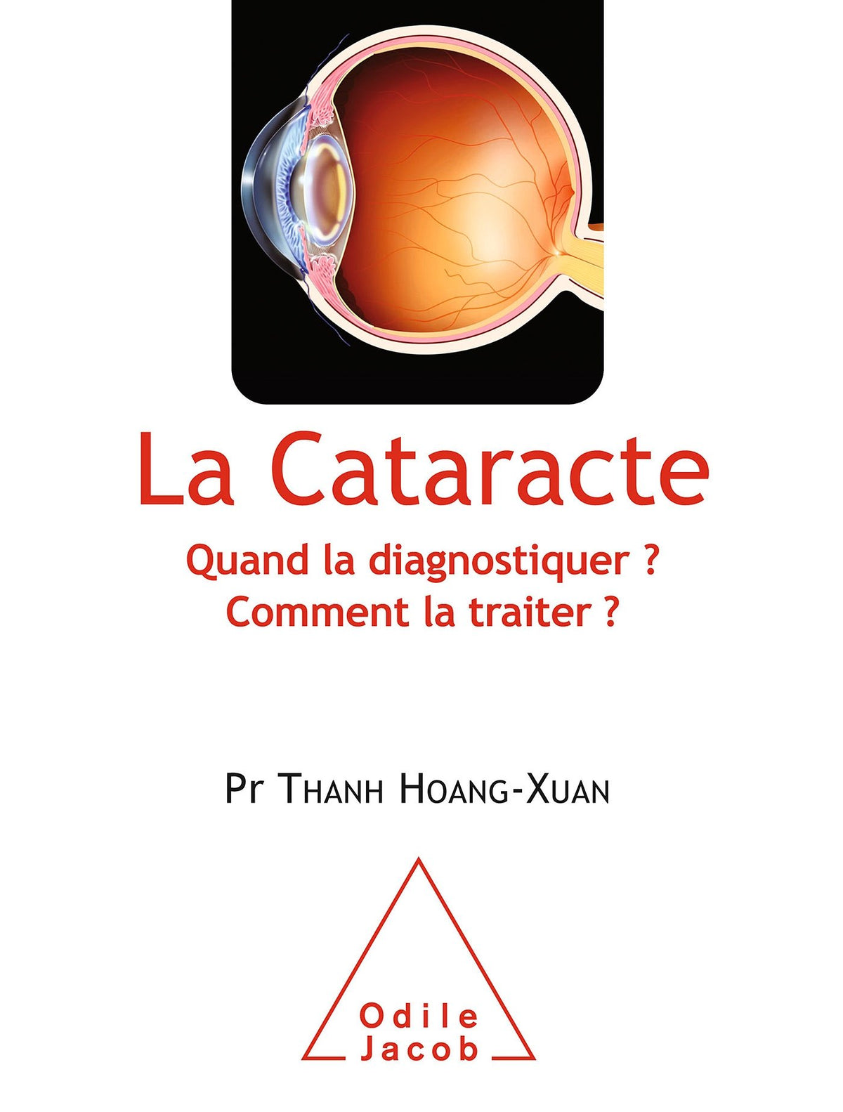 La Cataracte: Quand la diagnostiquer ? Comment la traiter ? 9782738127235
