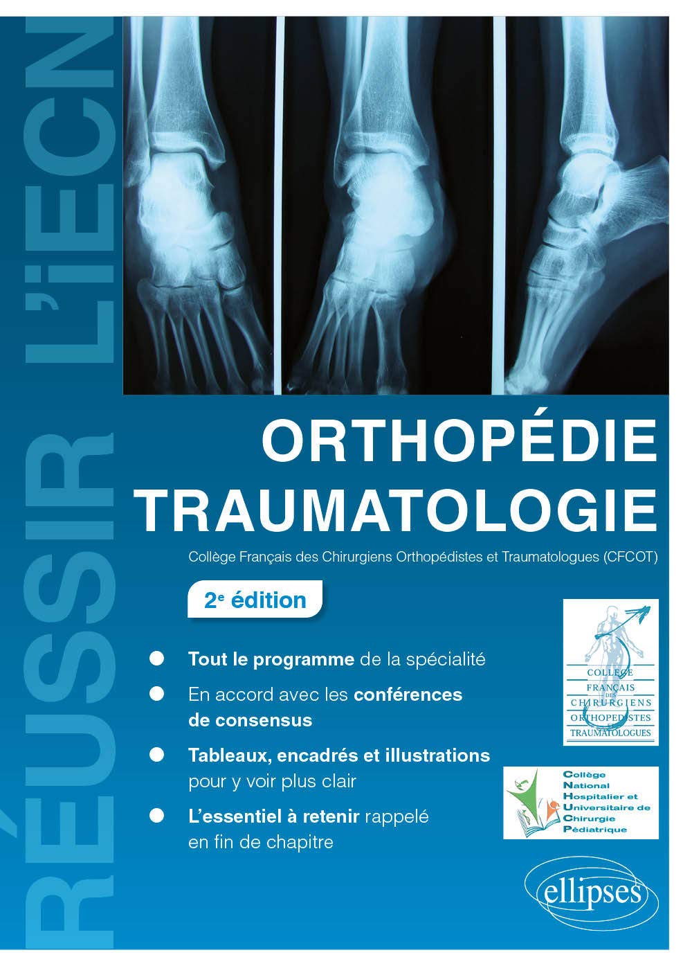 Orthopédie traumatologie 9782340032828