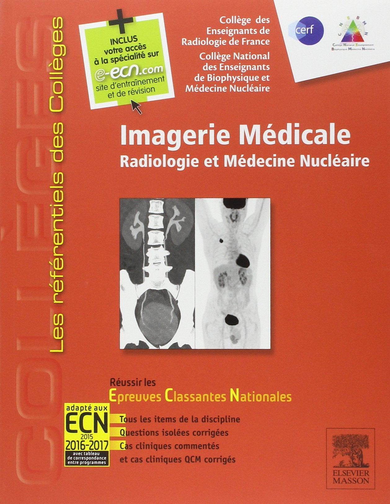 Imagerie médicale: Radiologie et médecine nucléaire. Réussir les ECNi 9782294731495