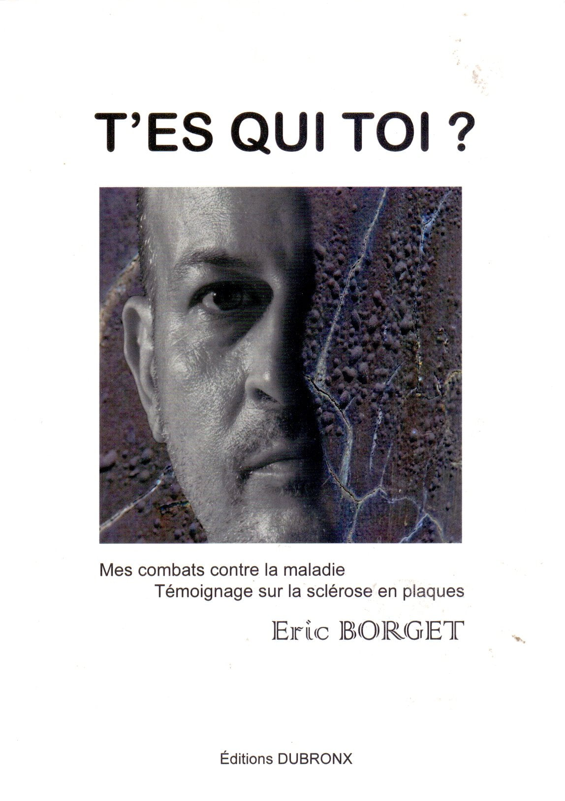 T'es qui toi ? Mes combats contre la maladie : témoignage sur la sclérose en plaques 9782954067001