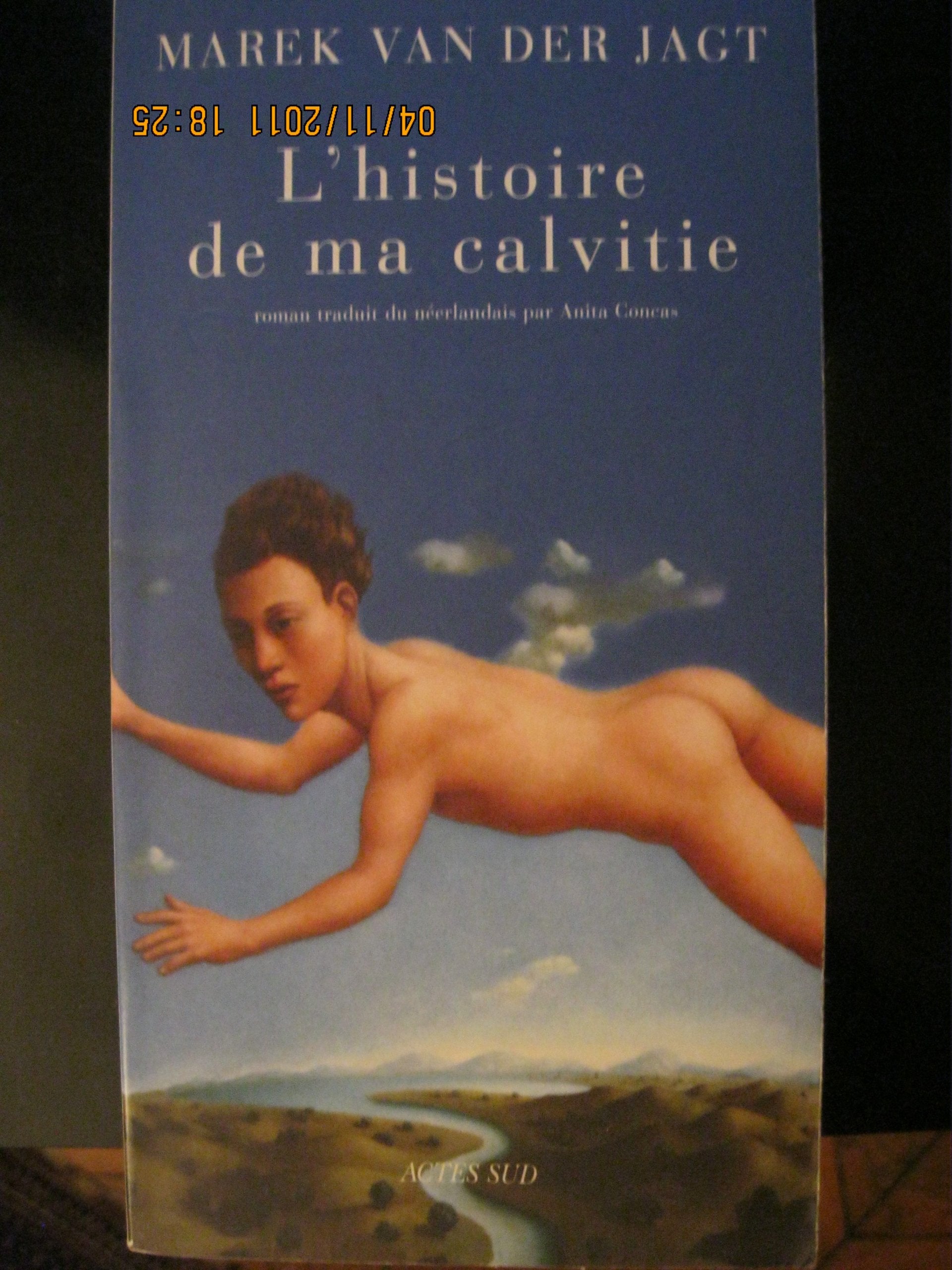 L'Histoire de ma calvitie 9782742742363