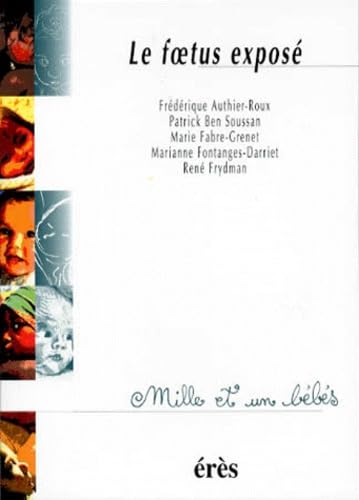 Le foetus exposé 9782865866571