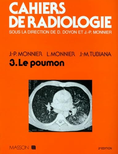 Cahiers de radiologie. Le poumon 9782225828362