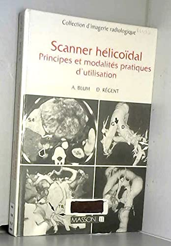Scanner hélicoïdal: Principes et modalités pratiques d'utilisation 9782225847707