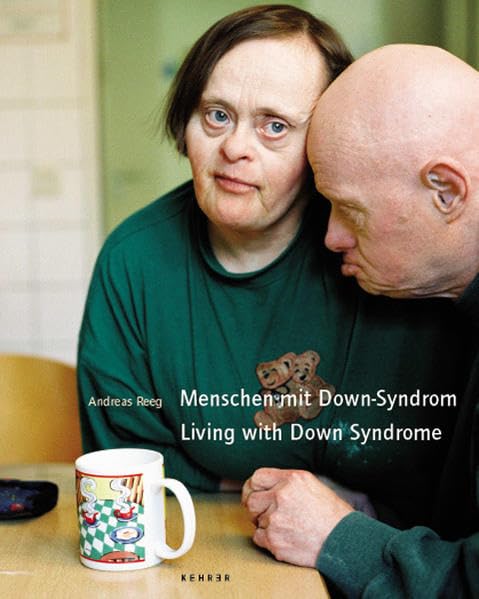 Menschen Mit Down-Syndrom/Living With Down Syndrome 9783933257321