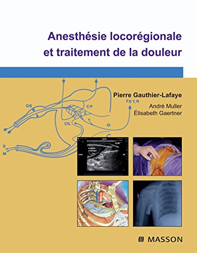 Anesthésie locorégionale et traitement de la douleur (Ancien Prix éditeur : 125 euros) 9782294050480