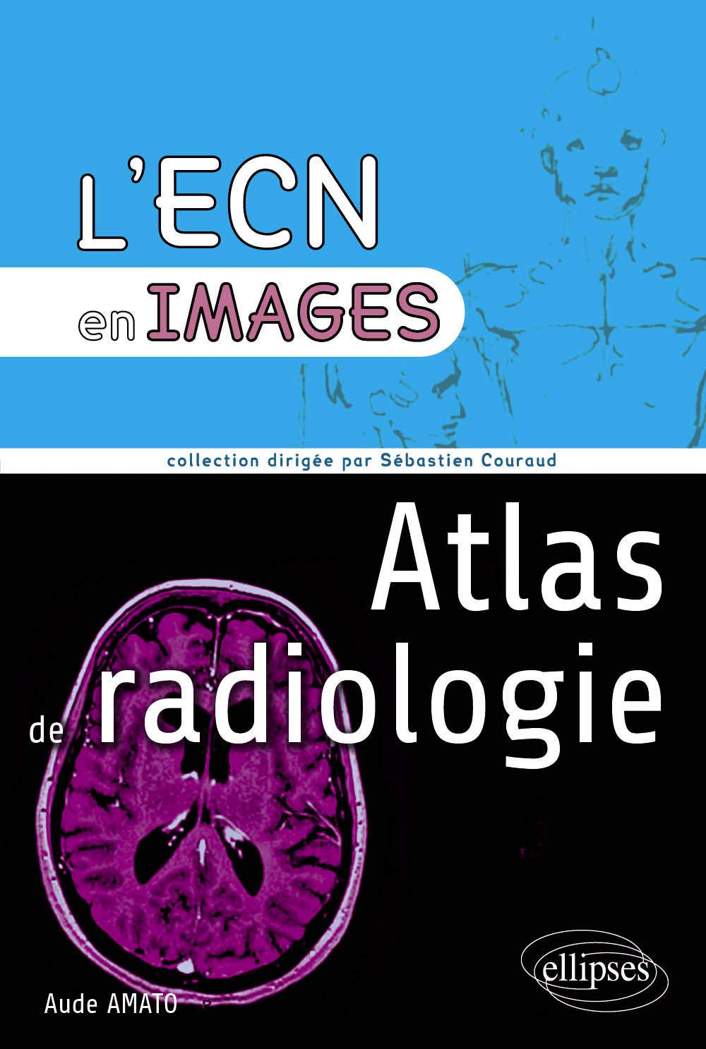 Atlas de Radiologie l'ECN En Images 9782729876036