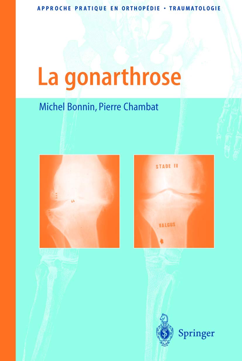 La gonarthrose 9782287597305