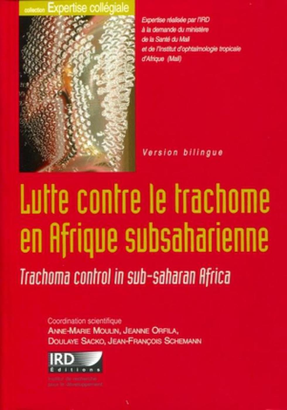 Lutte contre le trachome en Afrique subsaharienne: Trachoma control in sub-saharan Africa. Version bilingue. Avec cd-rom. 9782709916011