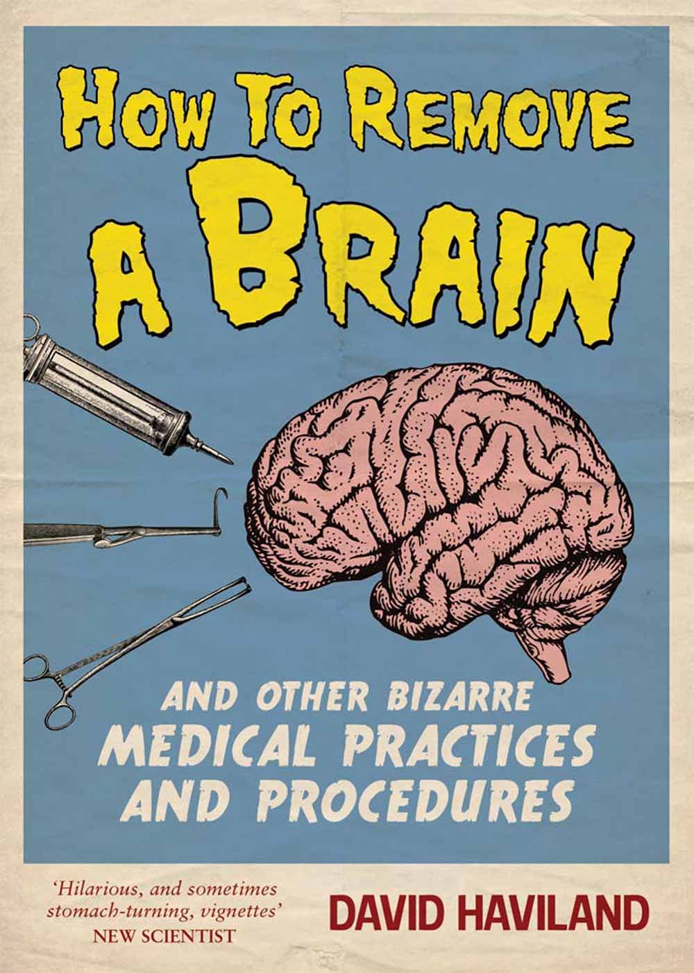 How to Remove a Brain: And Other Bizarre Medical Practices 9781849532501