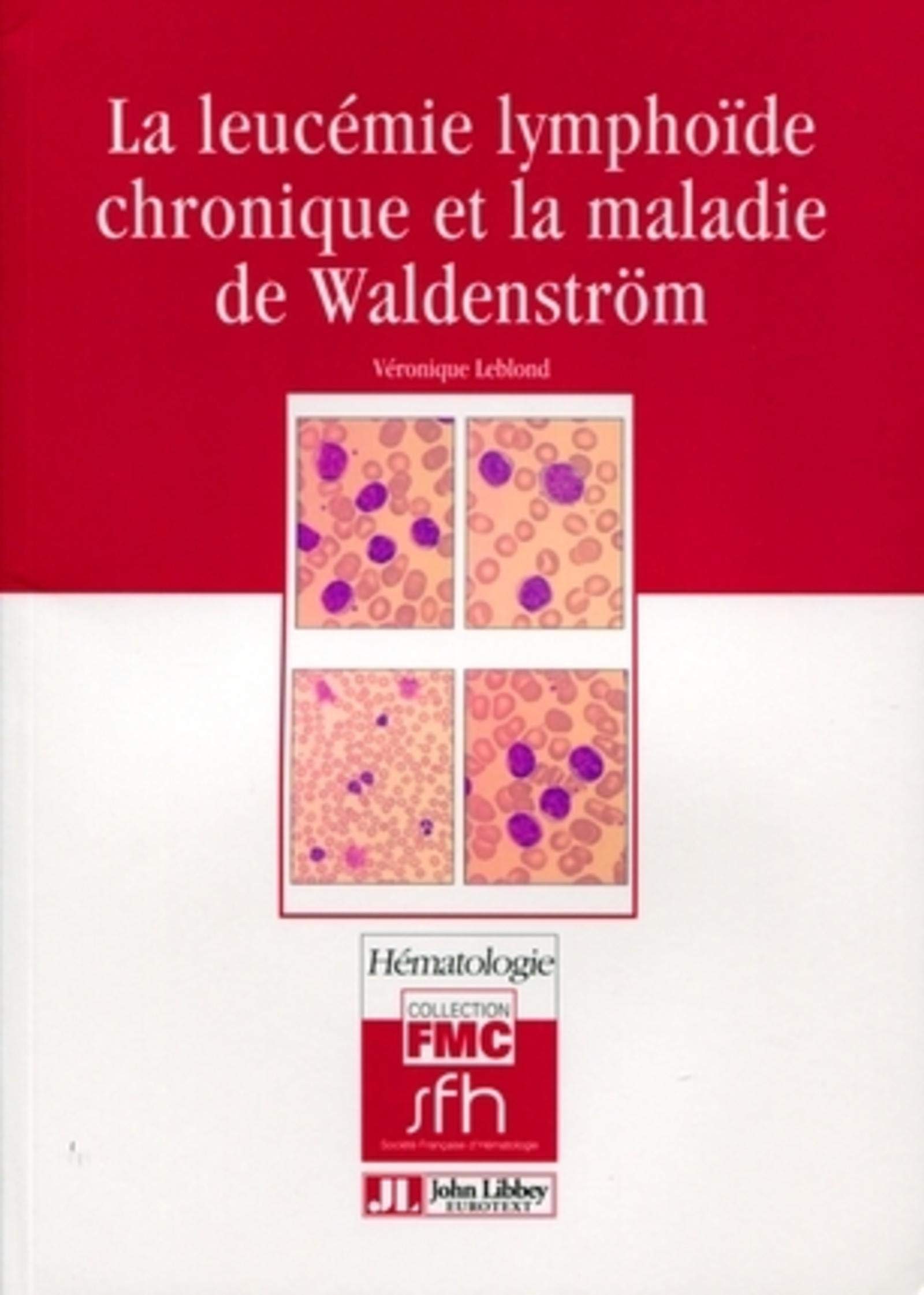 LA LEUCEMIE LYMPHOIDE CHRONIQUE ET LA MALADIE DE WALDENSTROM 9782742007363