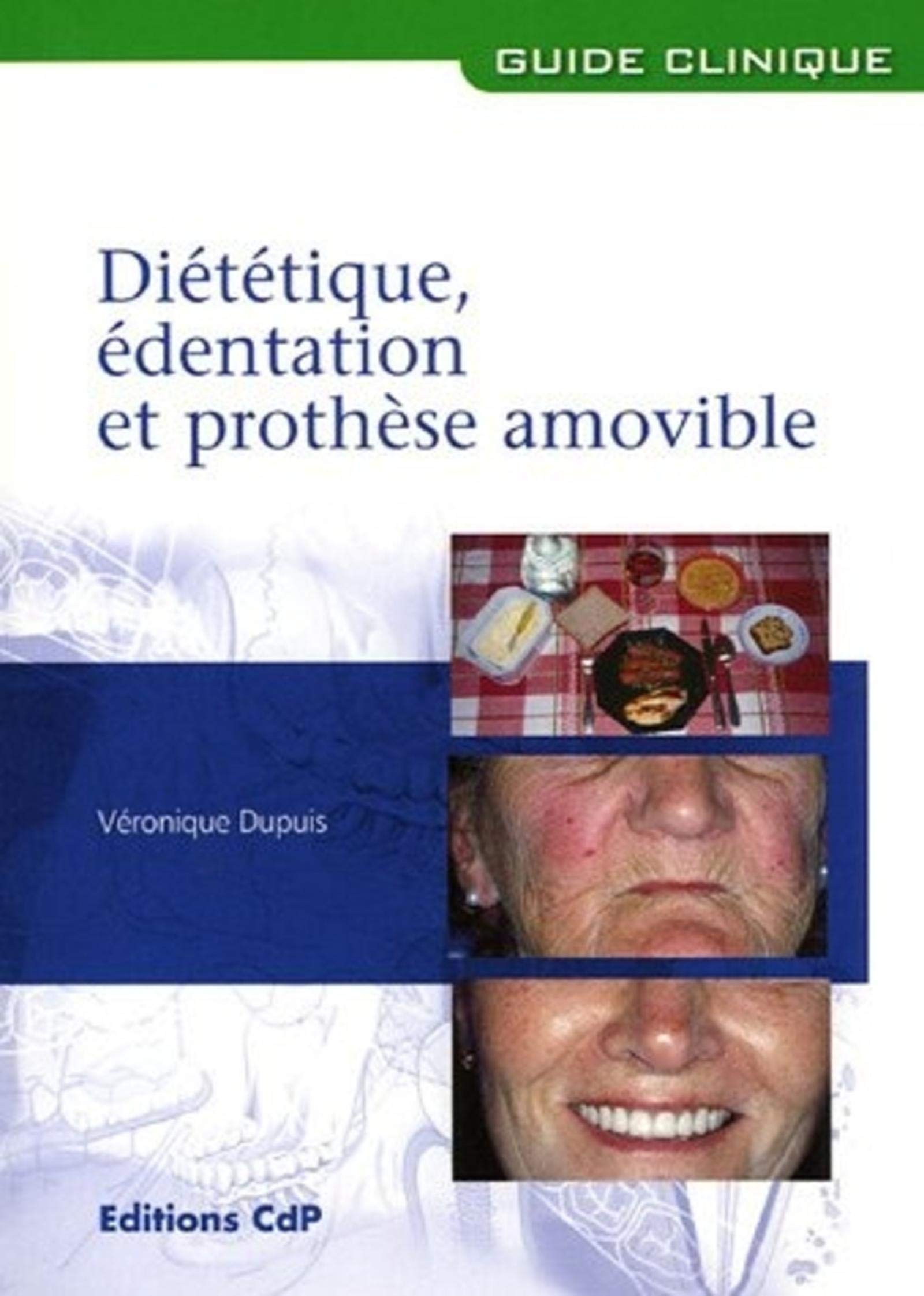 Diététique, édentation et prothèse amovible 9782843610875