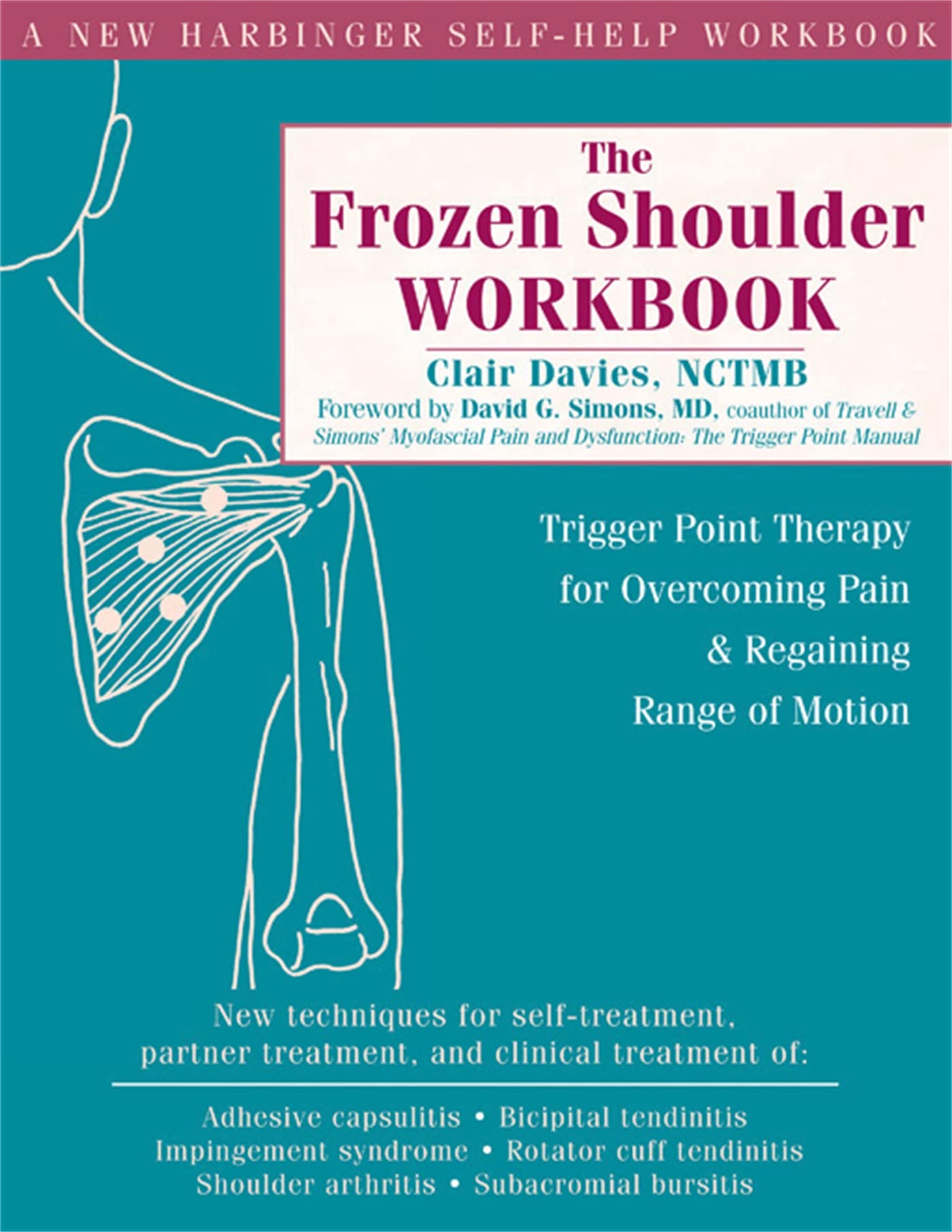 The Frozen Shoulder Workbook: Trigger Point Therapy for Overcoming Pain & Regaining Range of Motion 9781572244474