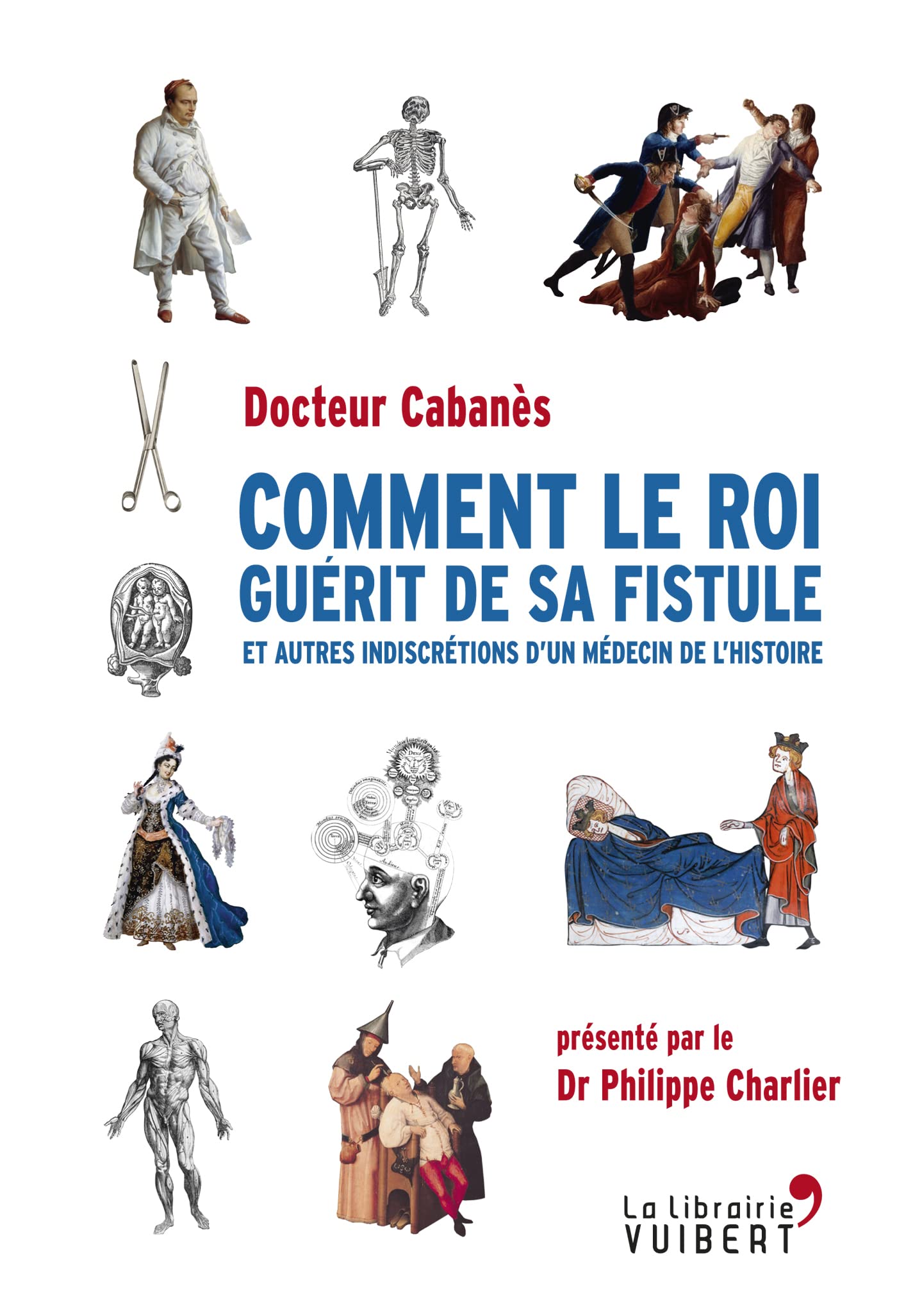 Comment le roi guérit de sa fistule: et autres indiscrétions d'un médecin de l'histoire 9782311013078