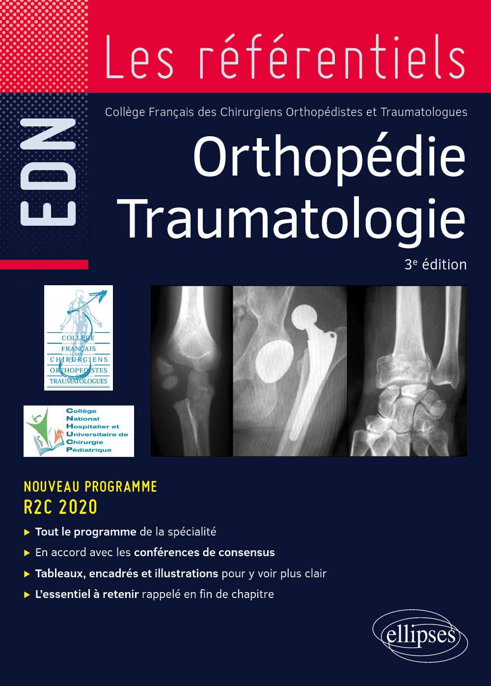 Orthopédie traumatologie 9782340058002