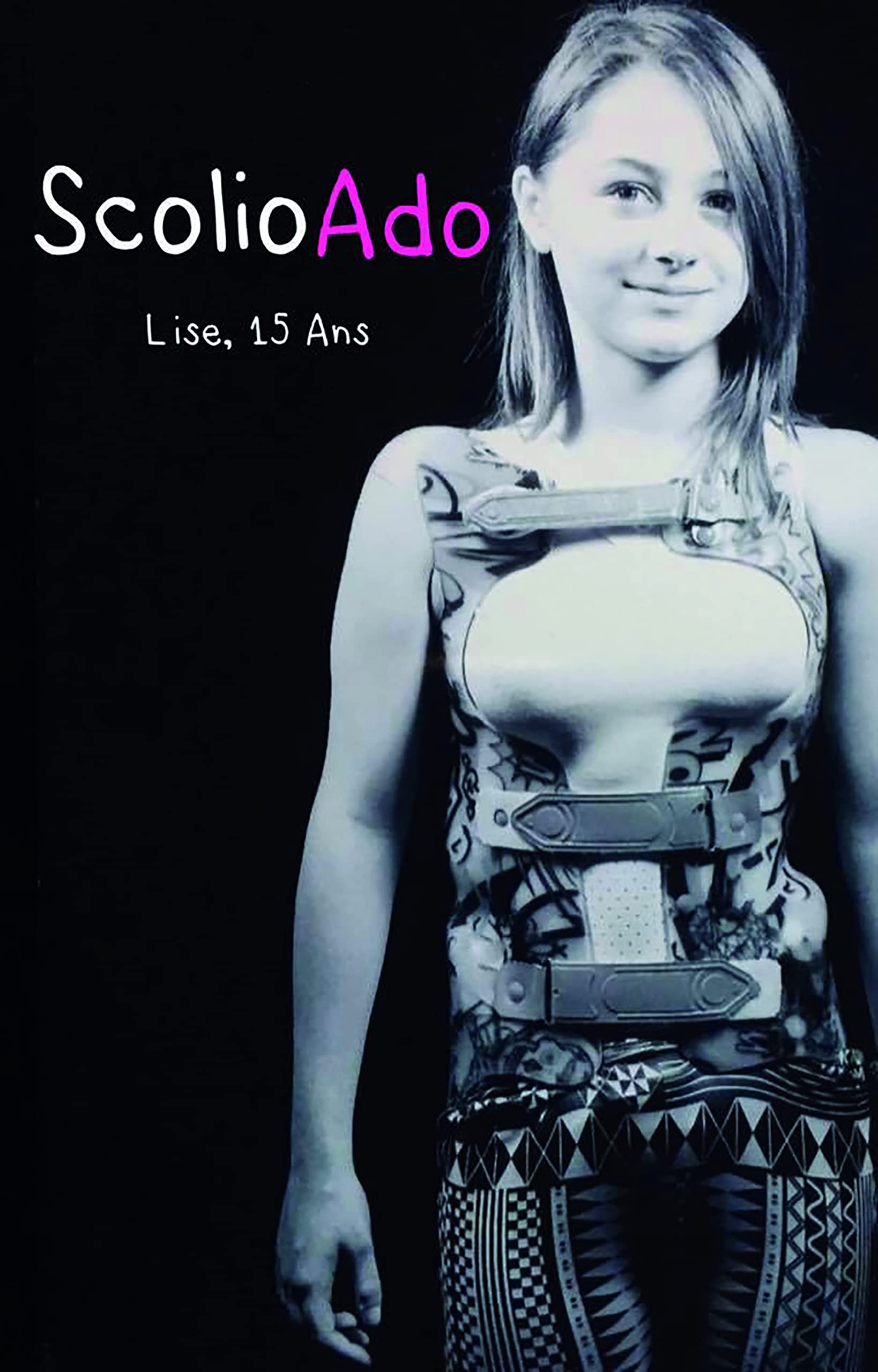 ScolioAdo Lise, 15 ans 9782414064618