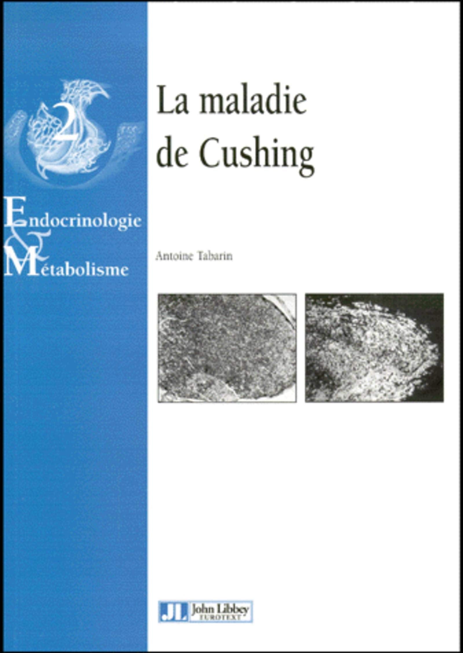 La maladie de Cushing 9782742002672