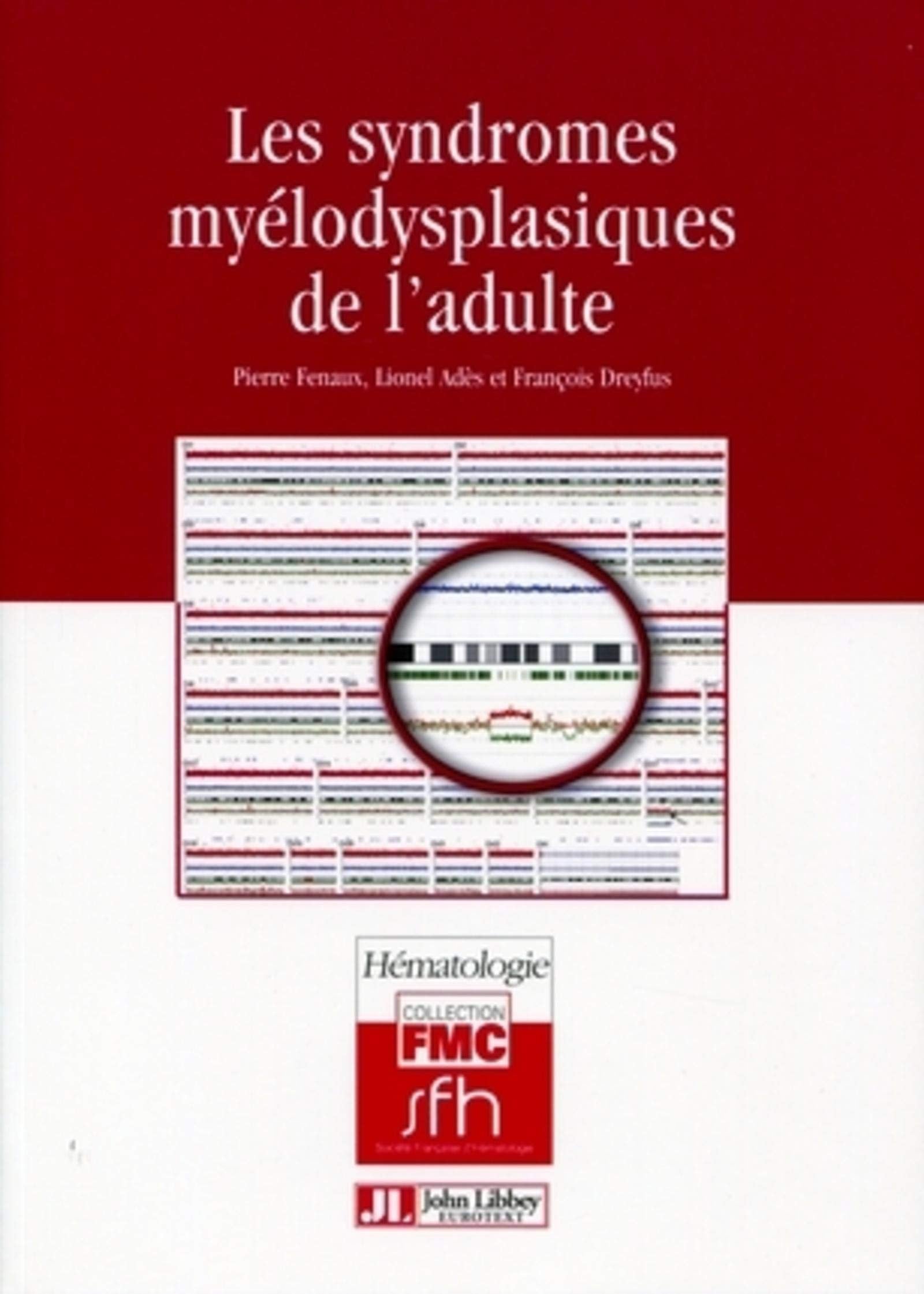 Les syndromes myélodysplasiques de l'adulte 9782742007950